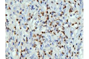IHC analysis of LBR using anti-LBR antibody (ABIN6719340). (Lamin B Receptor 抗体  (AA 102-209))