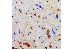 Immunohistochemical analysis of NAA15 staining in human brain formalin fixed paraffin embedded tissue section. (NAA15 抗体  (Center))