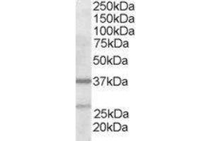 ABIN2561219 staining (2µg/ml) of Human Liver lysate (RIPA buffer, 35µg total protein per lane). (ARPC1B 抗体  (N-Term))
