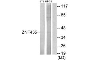 Western Blotting (WB) image for anti-Zinc Finger and SCAN Domain Containing 16 (ZSCAN16) (Internal Region) antibody (ABIN1849977) (ZSCAN16 抗体  (Internal Region))