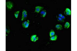 Immunofluorescent analysis of MCF-7 cells using ABIN7161314 at dilution of 1:100 and Alexa Fluor 488-congugated AffiniPure Goat Anti-Rabbit IgG(H+L) (Neuroligin 1 抗体  (AA 51-300))