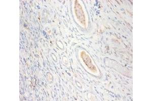 Immunohistochemistry of paraffin-embedded human kidney tissue using ABIN7148667 at dilution of 1:100 (CKMT1A 抗体  (AA 40-417))