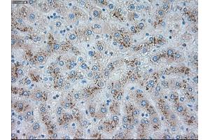 Immunohistochemical staining of paraffin-embedded pancreas tissue using anti-TRPM4mouse monoclonal antibody. (TRPM4 抗体)