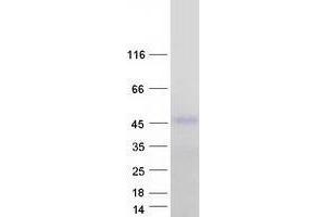 Western Blotting (WB) image for Zinc Finger, FYVE Domain Containing 27 (ZFYVE27) (Transcript Variant 6) protein (Myc-DYKDDDDK Tag) (ABIN2735875)
