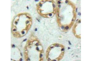 Used in DAB staining on fromalin fixed paraffin-embedded Kidney tissue (Thrombomodulin 抗体  (AA 31-169))