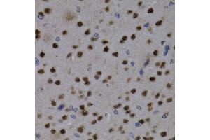Immunohistochemistry of paraffin-embedded mouse brain using MEF2C antibody at dilution of 1:200 (400x lens). (MEF2C 抗体)