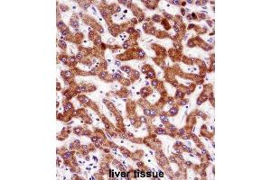 Immunohistochemistry (IHC) image for anti-Indian Hedgehog (IHH) antibody (ABIN2998360) (Indian Hedgehog 抗体)