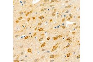 Immunohistochemistry of paraffin embedded rat brain using NECAB1 (ABIN7074753) at dilution of 1: 5000 (400x lens)