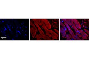 Immunohistochemistry (IHC) image for anti-Enolase 1 (ENO1) (Middle Region) antibody (ABIN2775758)