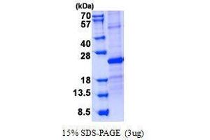 Figure annotation denotes ug of protein loaded and % gel used. (SOSTDC1 蛋白)