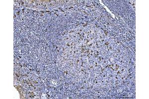 IHC analysis of CHM using anti-CHM antibody (ABIN6719537).