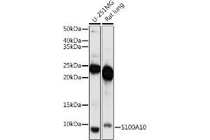 Western blot analysis of extracts of various cell lines, using S100 antibody (ABIN7270123) at 1:1000 dilution. (S100A10 抗体  (AA 1-97))
