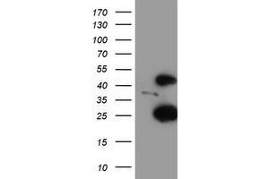 HEK293T cells were transfected with the pCMV6-ENTRY control (Left lane) or pCMV6-ENTRY CENPH (Right lane) cDNA for 48 hrs and lysed. (CENPH 抗体)