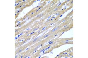 Immunohistochemistry of paraffin-embedded mouse heart using HSPB2 antibody (ABIN5971309) at dilution of 1/200 (40x lens). (HSPB2 抗体)