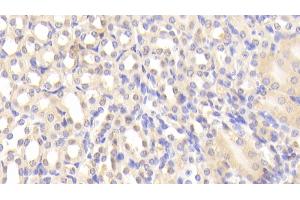 Immunohistochemistry (IHC) image for anti-Leukotriene A4 Hydrolase (LTA4H) (AA 135-272) antibody (ABIN7435448)