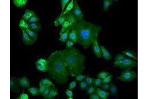 Immunofluorescence (IF) image for anti-Epidermal Growth Factor Receptor (EGFR) antibody (Alexa Fluor 488) (ABIN2657498) (EGFR 抗体  (Alexa Fluor 488))