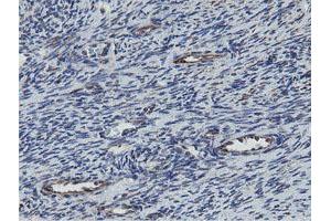 Image no. 2 for anti-Mitochondrial Ribosomal Protein S27 (MRPS27) (AA 151-414) antibody (ABIN1490969) (MRPS27 抗体  (AA 151-414))