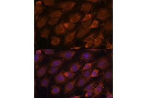 Immunofluorescence analysis of C6 cells using CREB3 antibody (ABIN6128862, ABIN6139013, ABIN6139015 and ABIN6222241) at dilution of 1:100. (CREB3 抗体  (AA 1-230))