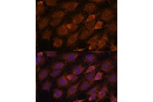 Immunofluorescence analysis of C6 cells using CREB3 antibody (ABIN6128862, ABIN6139013, ABIN6139015 and ABIN6222241) at dilution of 1:100. (CREB3 抗体  (AA 1-230))