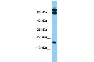 Host: Rabbit Target Name: B9D2 Sample Type: Fetal Brain lysates Antibody Dilution: 1. (B9D2 抗体  (N-Term))