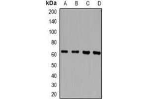 Western blot analysis of RLK expression in Jurkat (A), THP1 (B), mouse spleen (C), rat spleen (D) whole cell lysates. (TXK 抗体)