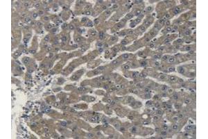 IHC-P analysis of Human Liver Tissue, with DAB staining. (Apolipoprotein L 2 抗体  (AA 186-337))