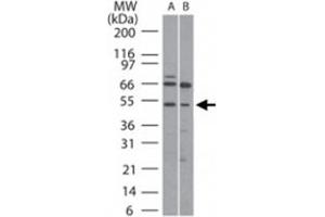 Western blot analysis of RUNX1 in (A) human Ramos and (B) mouse Raw cell lysate using RUNX1 polyclonal antibody  at 5 ug/mL .