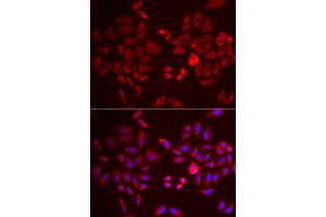 Immunofluorescence analysis of U2OS cells using PDK4 antibody (ABIN5971569). (PDK4 抗体)