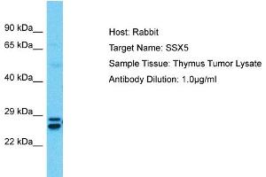 Host:  Rabbit  Target Name:  SSX5  Sample Type:  Thymus Tumor lysates  Antibody Dilution:  1. (SSX5 抗体  (C-Term))