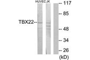 Western blot analysis of extracts from Jurkat/HuvEc cells, using TBX22 Antibody.