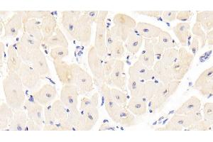 Immunohistochemistry (IHC) image for anti-Cystatin E/M (CST6) (AA 29-149) antibody (ABIN7436651)