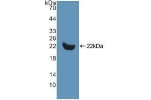 Detection of Recombinant MMP13, Human using Polyclonal Antibody to Matrix Metalloproteinase 13 (MMP13) (MMP13 抗体  (AA 290-468))