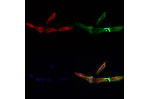 C1orf163 Antibody staining Hela cells by IF/ICC. (C1orf163 抗体  (Internal Region))