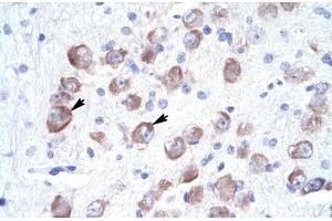 Immunohistochemical staining (Formalin-fixed paraffin-embedded sections) of human brain with LARP1 polyclonal antibody . (LARP1 抗体  (AA 701-750))