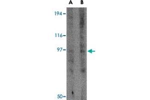 Western blot analysis of GRIK3 in human brain tissue lysate with GRIK3 polyclonal antibody  at (A) 1 and (B) 2 ug/mL . (GRIK3 抗体  (N-Term))