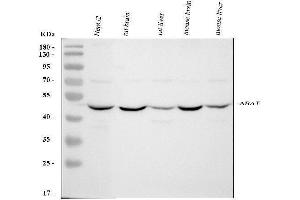 Western blot analysis of ABAT using anti-ABAT antibody (ABIN4886408). (ABAT 抗体  (AA 388-500))