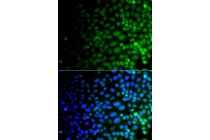 Immunofluorescence analysis of A549 cells using ULK4 antibody. (ULK4 抗体)