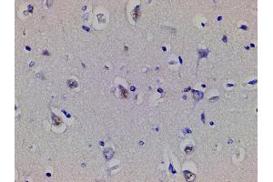 Immunohistochemistry (IHC) image for anti-Cofilin 1 (CFL1) (pSer3) antibody (ABIN6255180)