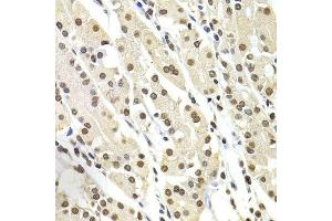 Immunohistochemistry (Paraffin-embedded Sections) (IHC (p)) image for anti-SRY (Sex Determining Region Y)-Box 5 (SOX5) (AA 1-120) antibody (ABIN6148303)