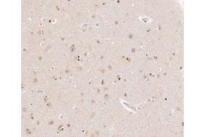 ABIN6266905 at 1/100 staining human brain tissue sections by IHC-P. (CKS2 抗体  (Internal Region))