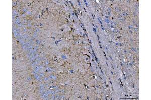 IHC analysis of Septin 2/SEPTIN2 using anti-Septin 2/SEPTIN2 antibody (ABIN7599275). (Septin 2 抗体  (AA 1-326))