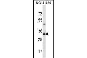 Western blot analysis in NCI-H460 cell line lysates (35ug/lane). (TBC1D21 抗体  (N-Term))