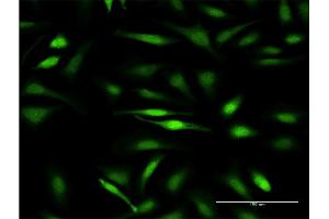Immunofluorescence (IF) image for anti-General Transcription Factor II I Repeat Domain-Containing 1 (GTF2IRD1) (AA 1-959) antibody (ABIN523047)