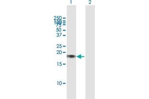 Western Blot analysis of CALM2 expression in transfected 293T cell line by CALM2 MaxPab polyclonal antibody. (Calmodulin 2 抗体  (AA 1-149))