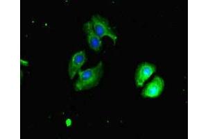 Immunofluorescent analysis of A549 cells using ABIN7147720 at dilution of 1:100 and Alexa Fluor 488-congugated AffiniPure Goat Anti-Rabbit IgG(H+L) (CHD4 抗体  (AA 1-219))
