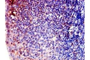 Immunohistochemistry (IHC) image for anti-Actin Related Protein 2/3 Complex, Subunit 1B, 41kDa (ARPC1B) (AA 16-316) antibody (ABIN7143081)