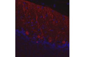 Indirect immunostaining of paraffin embedded mouse cerebellum section (dilution 1 : 200; red).