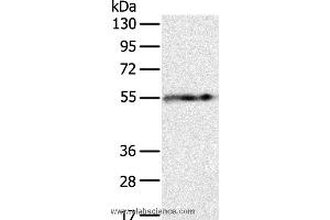 Western blot analysis of Human fat tissue, using PLIN1 Polyclonal Antibody at dilution of 1:250 (PLIN1 抗体)