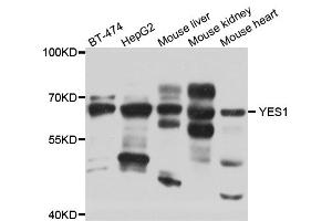 Western blot analysis of extracts of various cell lines, using YES1 antibody (ABIN5974700) at 1/1000 dilution. (YES1 抗体)