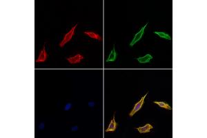 ABIN6257771 and ABIN6275570 staining Hela cells by IF/ICC.